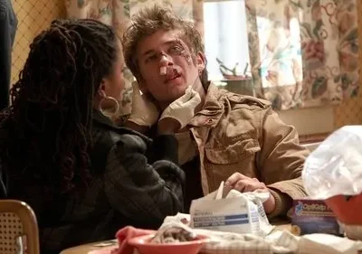Mulher com dreads cuida de homem com rosto machucado e nariz enfaixado, usando luvas. Suprimentos médicos em mesa doméstica. Cena de cuidado.