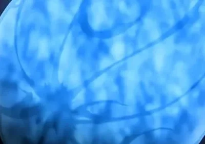 Cérebro azul brilhante e translúcido contra um fundo escuro, com veias ou circuitos visíveis. Clima de ficção científica.